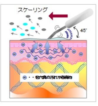 キセノン光線治療器「ビオラ　V30」