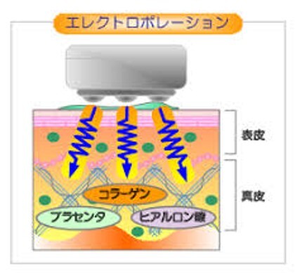 キセノン光線治療器「ビオラ　V30」