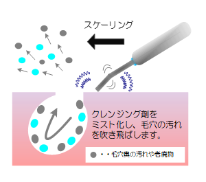 キセノン光線治療器「ビオラ V30」